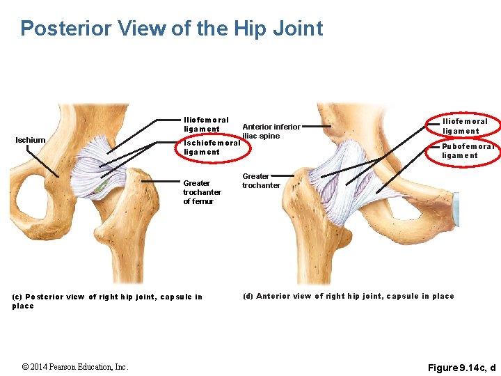 Posterior View of the Hip Joint Iliofemoral ligament Ischium Ischiofemoral ligament Greater trochanter of