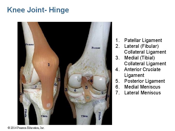 Knee Joint- Hinge 1. Patellar Ligament 2. Lateral (Fibular) Collateral Ligament 3. Medial (Tibial)