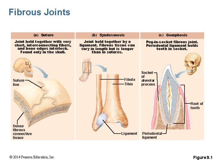 Fibrous Joints (a) Suture (b) Syndesmosis (c) Gomphosis Joint held together with very short,