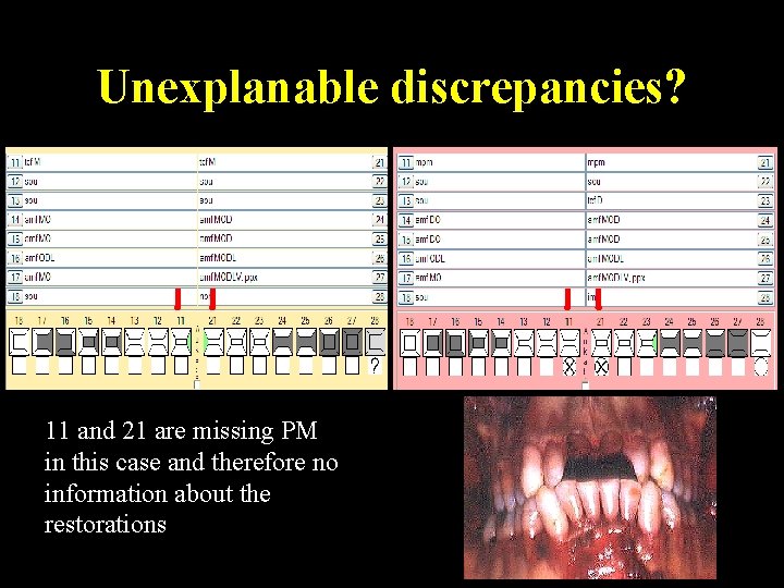 Unexplanable discrepancies? 11 and 21 are missing PM in this case and therefore no