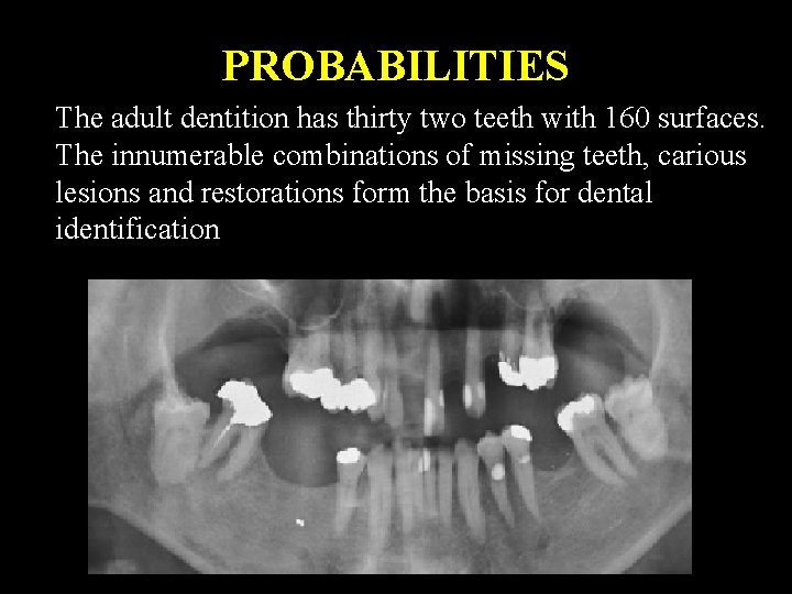 PROBABILITIES The adult dentition has thirty two teeth with 160 surfaces. The innumerable combinations