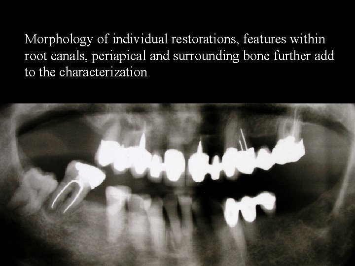 Morphology of individual restorations, features within root canals, periapical and surrounding bone further add