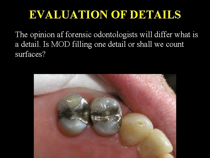 EVALUATION OF DETAILS The opinion af forensic odontologists will differ what is a detail.