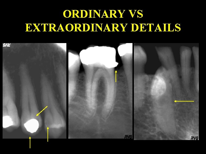 ORDINARY VS EXTRAORDINARY DETAILS 