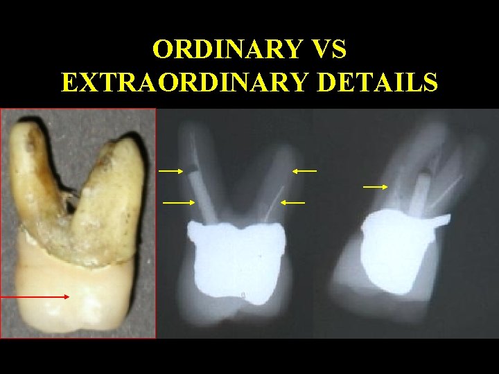 ORDINARY VS EXTRAORDINARY DETAILS 
