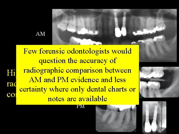 AM Few forensic odontologists would question the accuracy of radiographic comparison between High certainity