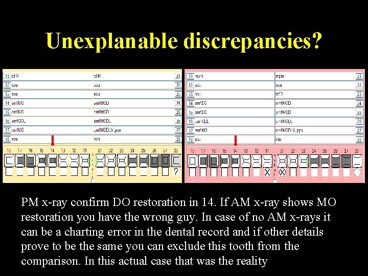 Unexplanable discrepancies? PM x-ray confirm DO restoration in 14. If AM x-ray shows MO