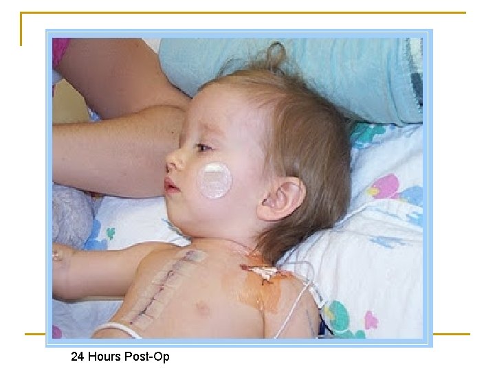 24 Hours Post-Op 