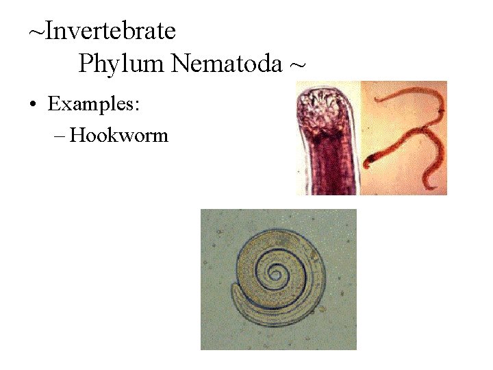 ~Invertebrate Phylum Nematoda ~ • Examples: – Hookworm 