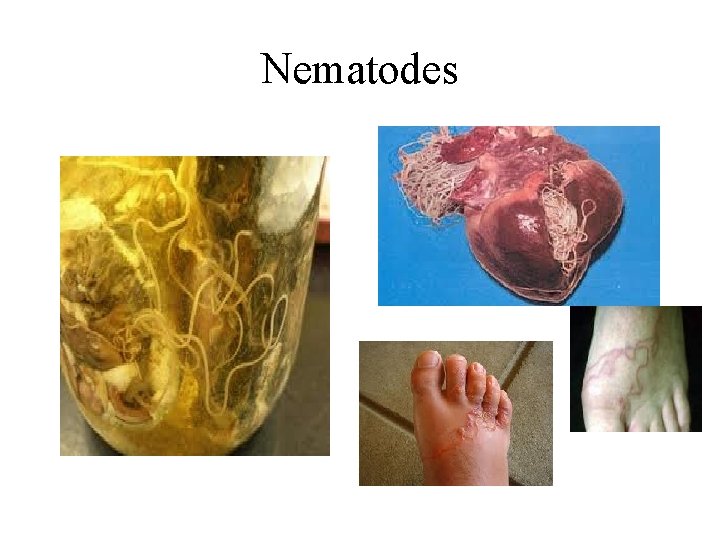 Nematodes 