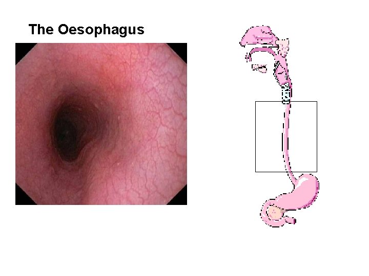 The Oesophagus 