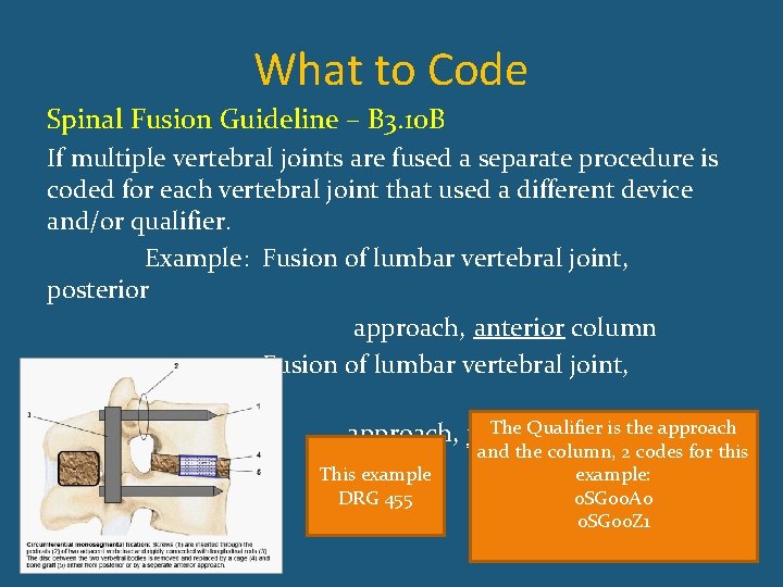 What to Code Spinal Fusion Guideline – B 3. 10 B If multiple vertebral