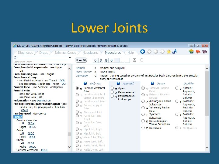 Lower Joints 