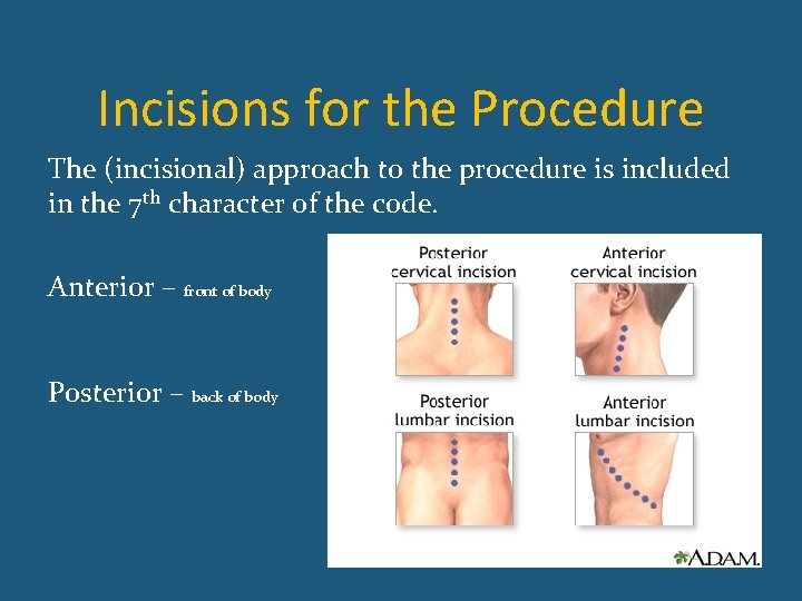 Incisions for the Procedure The (incisional) approach to the procedure is included in the