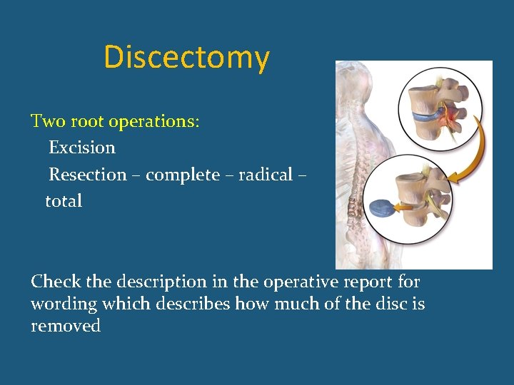 Discectomy Two root operations: Excision Resection – complete – radical – total Check the