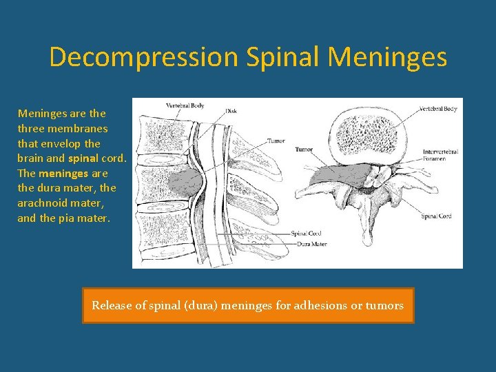 Decompression Spinal Meninges are three membranes that envelop the brain and spinal cord. The