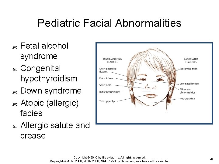 Pediatric Facial Abnormalities Fetal alcohol syndrome Congenital hypothyroidism Down syndrome Atopic (allergic) facies Allergic Pediatric Facial Abnormalities Fetal alcohol syndrome Congenital hypothyroidism Down syndrome Atopic (allergic) facies Allergic