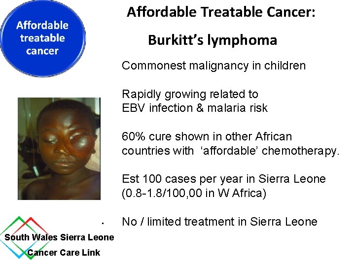 Affordable Treatable Cancer: Burkitt’s lymphoma Commonest malignancy in children Rapidly growing related to EBV