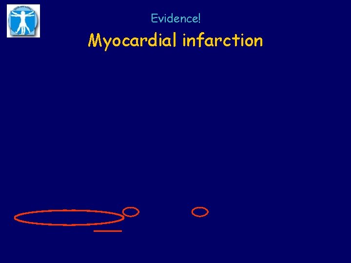 Evidence! Myocardial infarction 