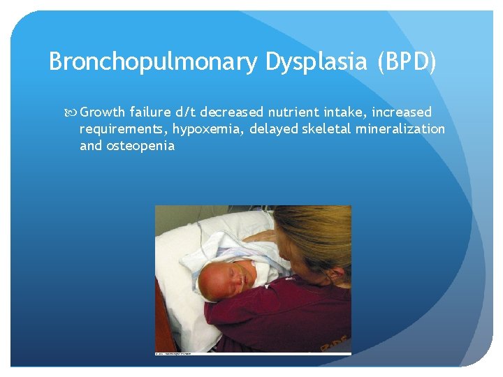 Bronchopulmonary Dysplasia (BPD) Growth failure d/t decreased nutrient intake, increased requirements, hypoxemia, delayed skeletal