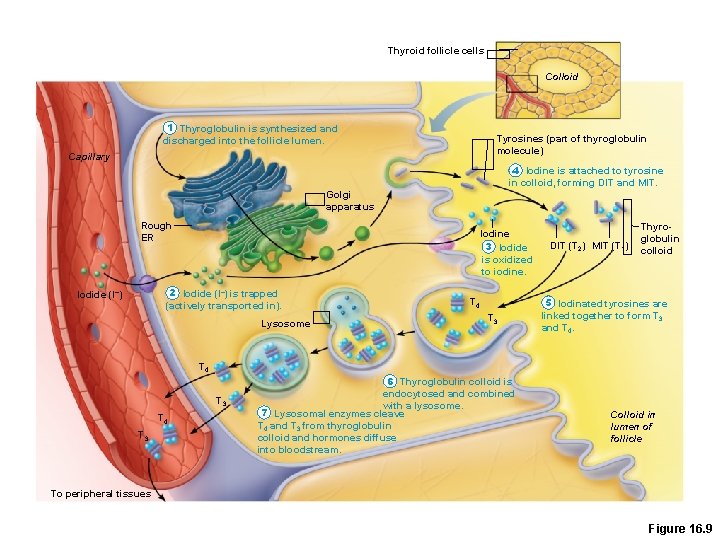 Thyroid follicle cells Colloid 1 Thyroglobulin is synthesized and discharged into the follicle lumen.