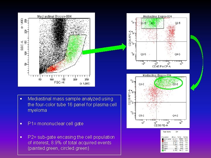 § Mediastinal mass sample analyzed using the four-color tube 16 panel for plasma cell