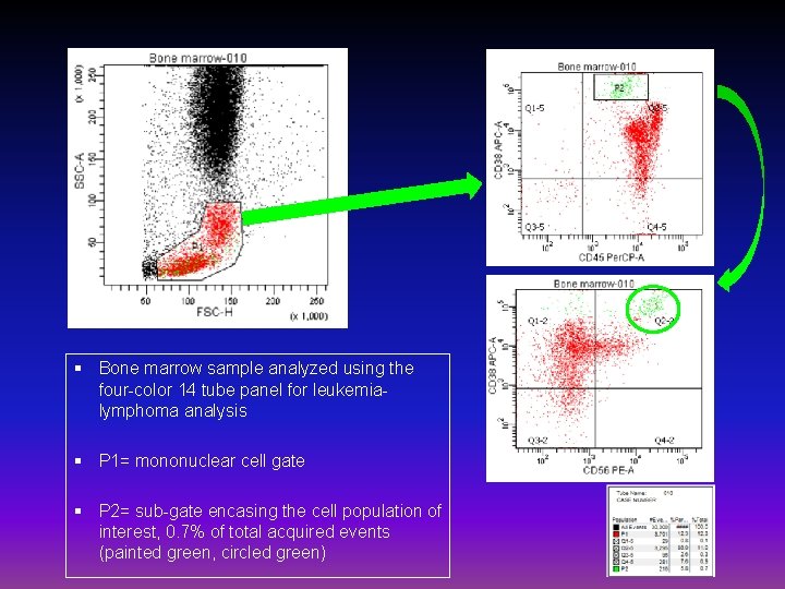 § Bone marrow sample analyzed using the four-color 14 tube panel for leukemialymphoma analysis