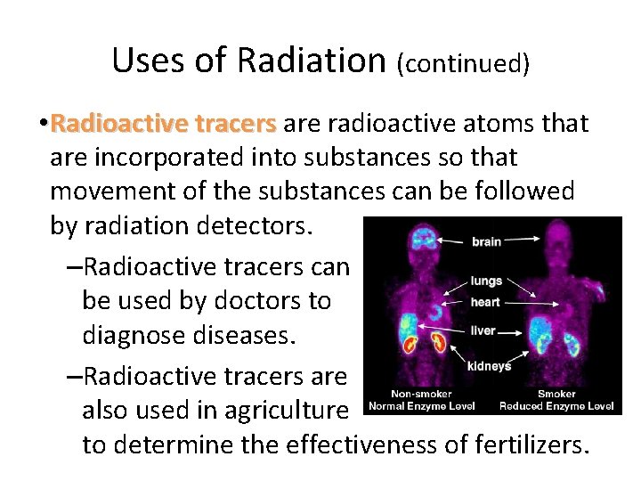 Uses of Radiation (continued) • Radioactive tracers are radioactive atoms that are incorporated into Uses of Radiation (continued) • Radioactive tracers are radioactive atoms that are incorporated into