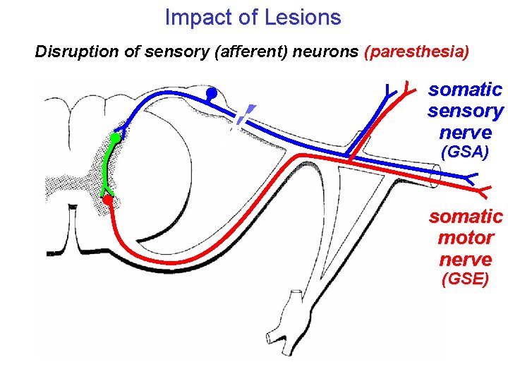 Impact of Lesions Disruption of sensory (afferent) neurons (paresthesia) somatic sensory nerve (GSA) somatic