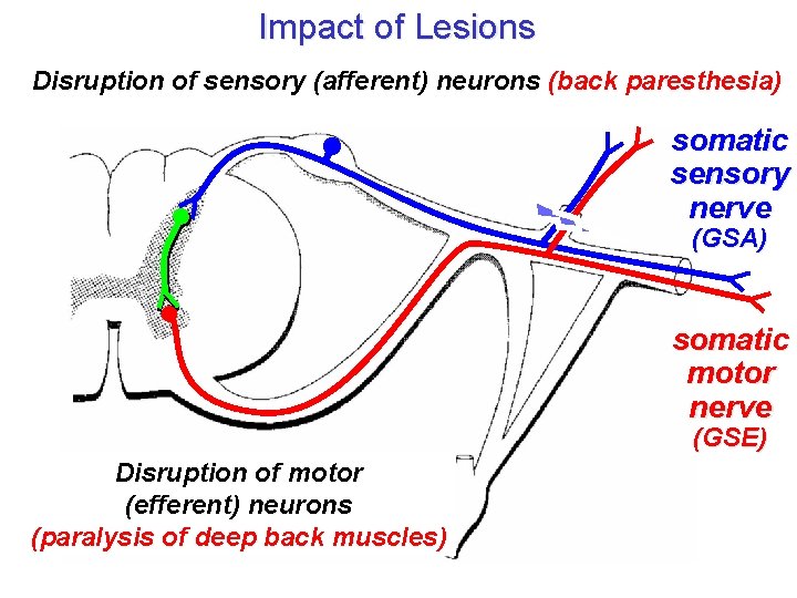 Impact of Lesions Disruption of sensory (afferent) neurons (back paresthesia) somatic sensory nerve (GSA)