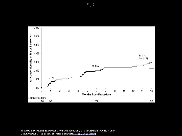 Fig 2 The Annals of Thoracic Surgery 2017 1031392 -1398 DOI: (10. 1016/j. athoracsur.