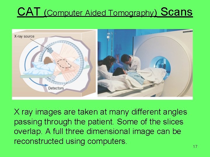 CAT (Computer Aided Tomography) Scans X ray images are taken at many different angles CAT (Computer Aided Tomography) Scans X ray images are taken at many different angles