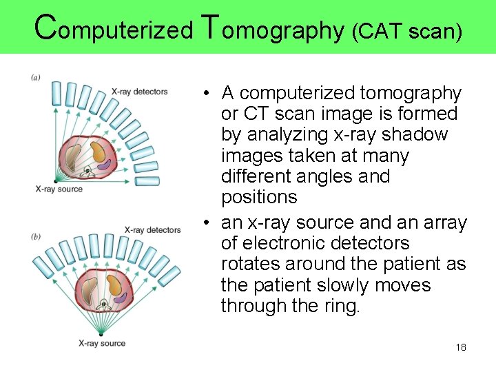 Computerized Tomography (CAT scan) • A computerized tomography or CT scan image is formed Computerized Tomography (CAT scan) • A computerized tomography or CT scan image is formed