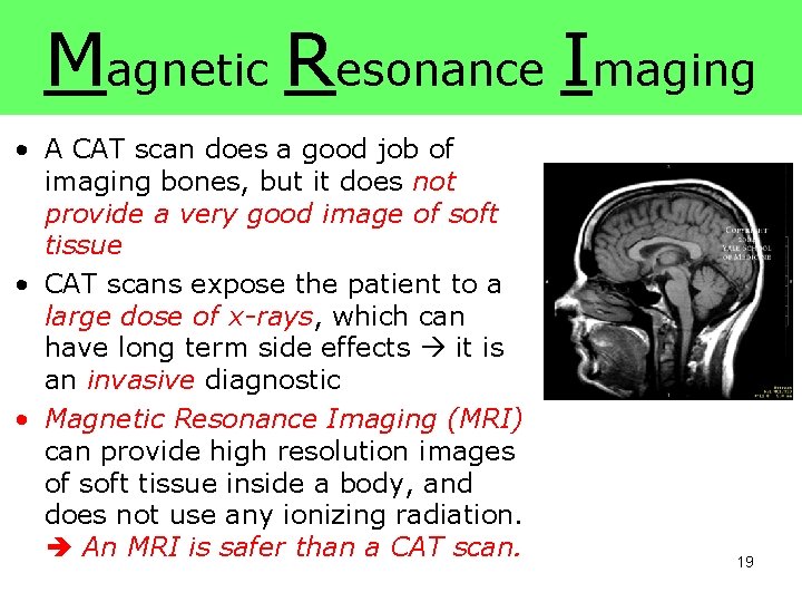 Magnetic Resonance Imaging • A CAT scan does a good job of imaging bones, Magnetic Resonance Imaging • A CAT scan does a good job of imaging bones,