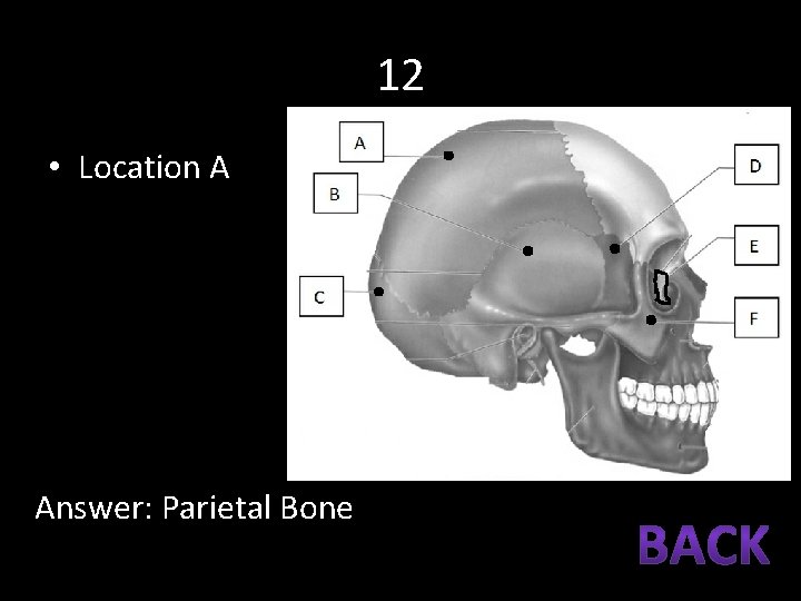 12 • Location A Answer: Parietal Bone 