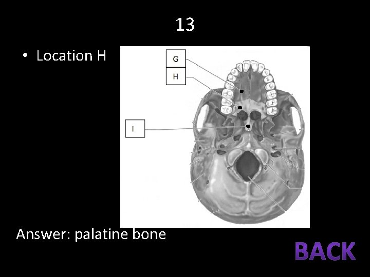 13 • Location H Answer: palatine bone 