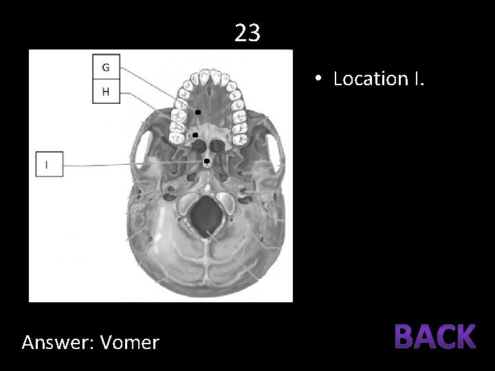 23 • Location I. Answer: Vomer 