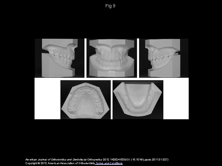 Fig 9 American Journal of Orthodontics and Dentofacial Orthopedics 2012 142524 -533 DOI: (10.