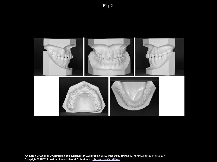 Fig 2 American Journal of Orthodontics and Dentofacial Orthopedics 2012 142524 -533 DOI: (10.
