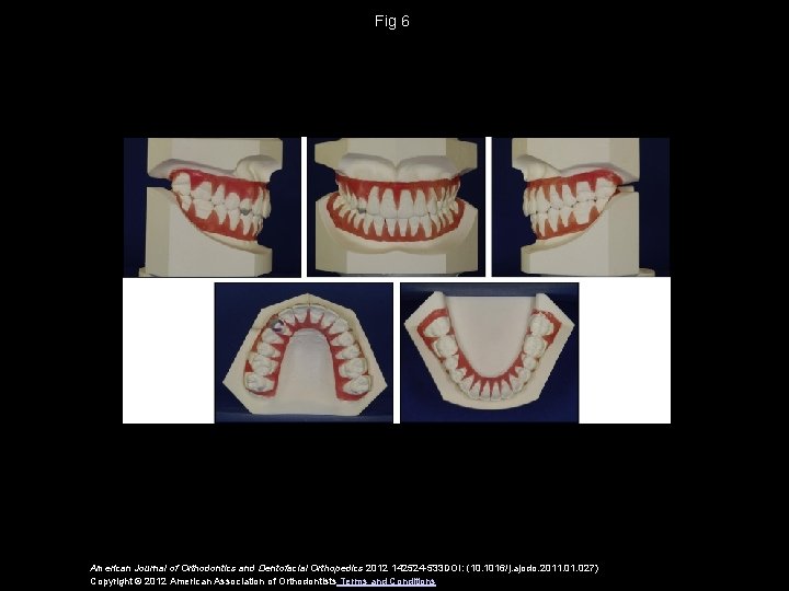 Fig 6 American Journal of Orthodontics and Dentofacial Orthopedics 2012 142524 -533 DOI: (10.