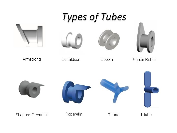 Types of Tubes Armstrong Shepard Grommet Donaldson Paparella Bobbin Triune Spoon Bobbin T-tube 