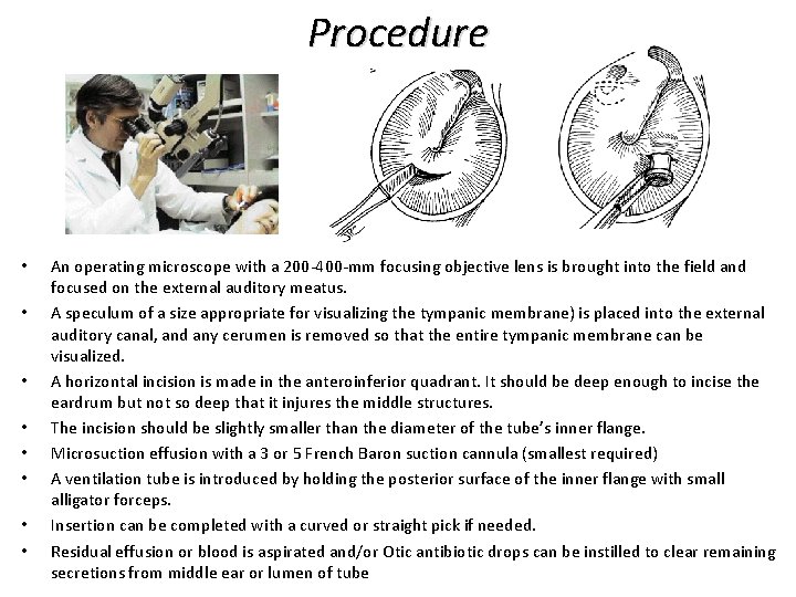 Procedure • • An operating microscope with a 200 -400 -mm focusing objective lens