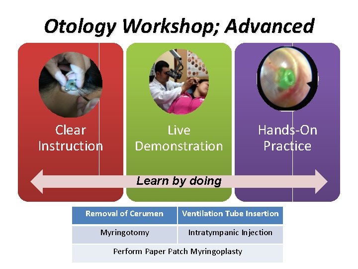 Otology Workshop; Advanced Clear Instruction Live Demonstration Hands-On Practice Learn by doing Removal of