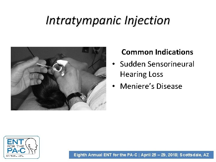 Intratympanic Injection Common Indications • Sudden Sensorineural Hearing Loss • Meniere’s Disease Eighth Annual