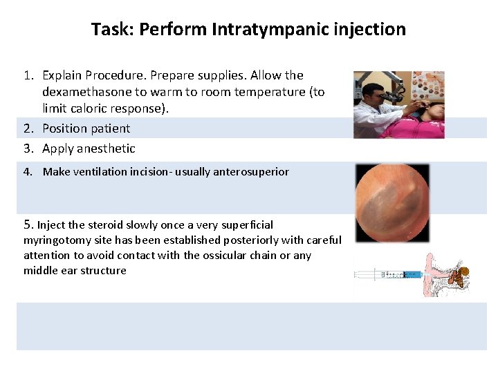 Task: Perform Intratympanic injection 1. Explain Procedure. Prepare supplies. Allow the dexamethasone to warm