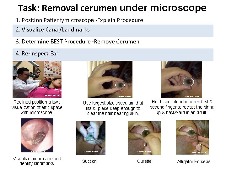 Task: Removal cerumen under microscope 1. Position Patient/microscope -Explain Procedure 2. Visualize Canal/Landmarks 3.
