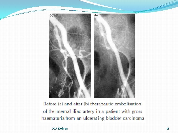 M. A. Kubtan 18 