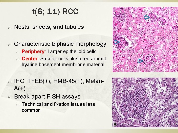 Surgicopathological Conference Presenter Changche Wu Md Supervisor Pinpen