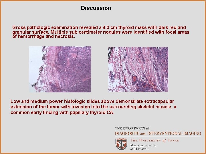 Discussion Gross pathologic examination revealed a 4. 0 cm thyroid mass with dark red