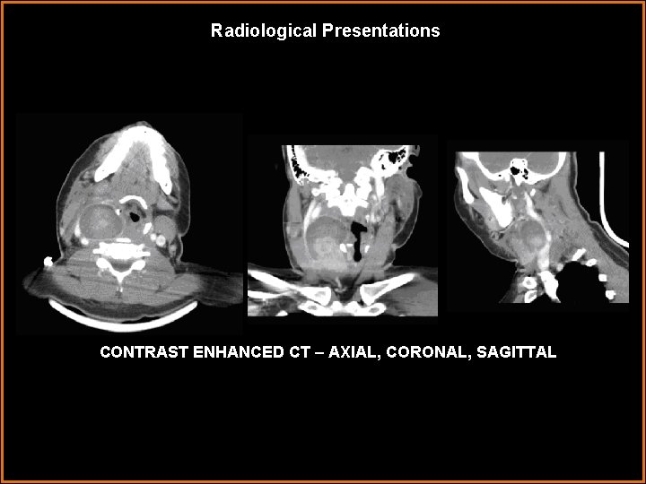 Radiological Presentations CONTRAST ENHANCED CT – AXIAL, CORONAL, SAGITTAL 